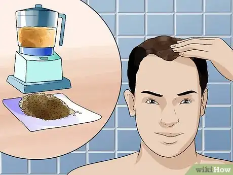 Imagen titulada Treat Male Pattern Hair Loss Step 11