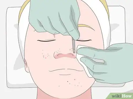 Imagen titulada Clean Clogged Pores Step 5