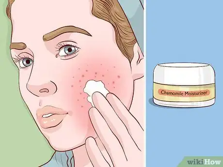 Imagen titulada Take Care of Your Skin With Natural Methods Step 11