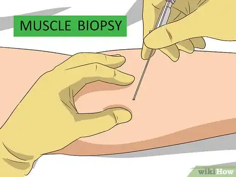 Imagen titulada Diagnose Muscular Dystrophy Step 11