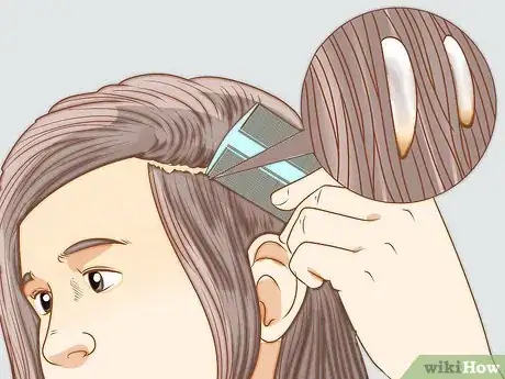 Imagen titulada Recognize Head Lice Step 2