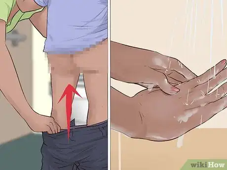 Imagen titulada Help a Male Child Provide a Urine Sample Step 16
