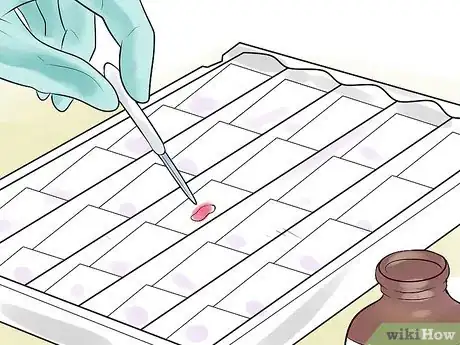 Imagen titulada Gram Stain Step 6