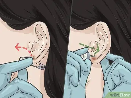 Imagen titulada Pierce Your Ear with a Safety Pin Step 10