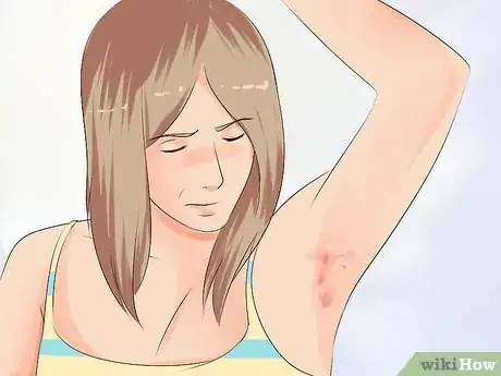 Imagen titulada Keep Your Underarms Fresh and Clean Step 13