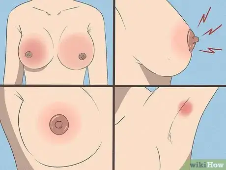 Imagen titulada Relieve Breast Engorgement Step 2