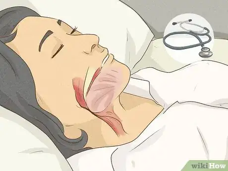 Imagen titulada Sleep with a Stomach Ulcer Step 7