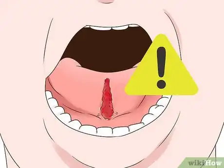 Imagen titulada Get a Longer Tongue Step 7