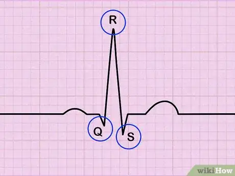 Imagen titulada Read an EKG Step 2