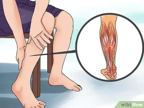 Imagen titulada Treat a Torn Calf Muscle Step 4