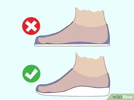 Imagen titulada Stop a Bunion from Growing Step 4