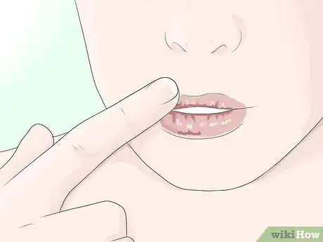 Imagen titulada Get Rid of Painful Cracked Lips Step 3