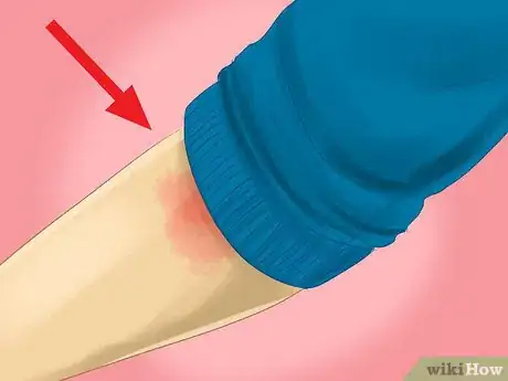 Imagen titulada Relieve Blister Pain Step 1