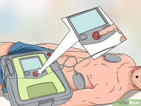 Imagen titulada Use a Defibrillator Step 10