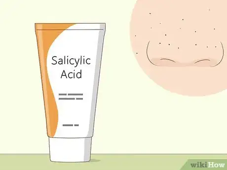 Imagen titulada Instantly Get Rid of a Pimple (Cotton Ball Popping Method) Step 4