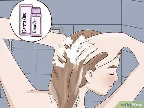 Imagen titulada Get Rid of Dandruff at Home Step 1