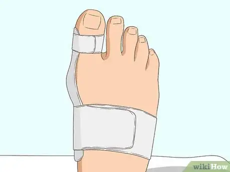Imagen titulada Stop a Bunion from Growing Step 8
