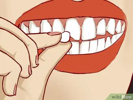 Imagen titulada Treat a Broken Tooth Step 9