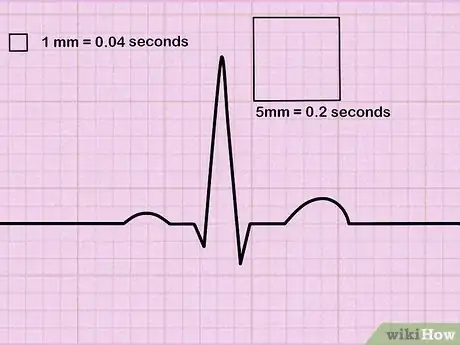 Imagen titulada Read an EKG Step 1