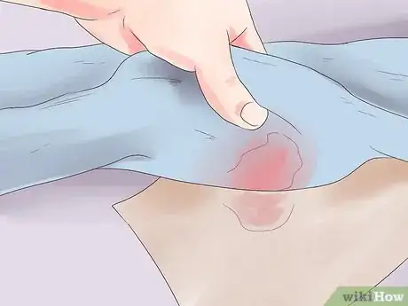 Imagen titulada Get Stains out of Clothes Step 21