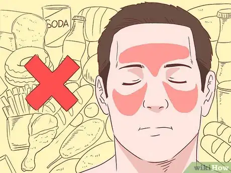 Imagen titulada Get Rid of a Headache Naturally Step 25