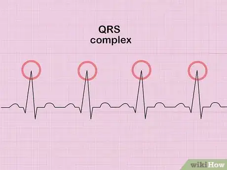 Imagen titulada Calculate Heart Rate from ECG Step 2