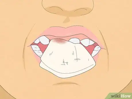 Imagen titulada Pull a Loose Tooth at Home Step 10