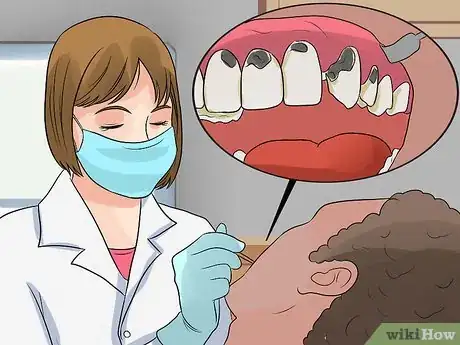 Imagen titulada Determine if a Tooth Needs to Be Pulled Step 8