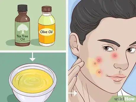 Imagen titulada Take Care of Your Skin With Natural Methods Step 12