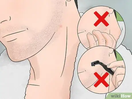 Imagen titulada Stop Itching After Shaving Step 1