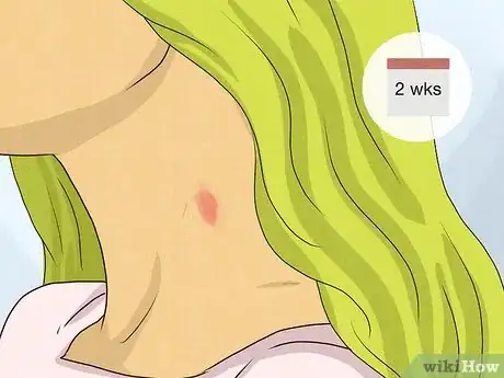 Imagen titulada Identify a Hickey Step 6