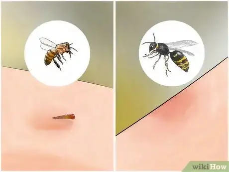 Imagen titulada Identify Insect Bites Step 4