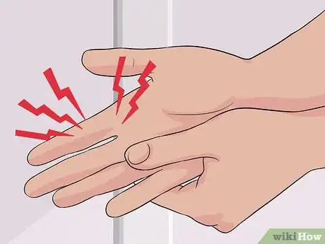 Imagen titulada Determine if a Finger Is Broken Step 1