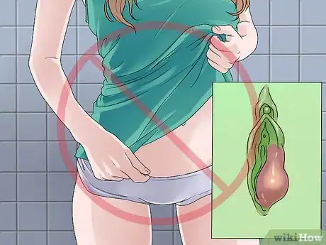 Imagen titulada Treat Vaginal Cysts Step 11