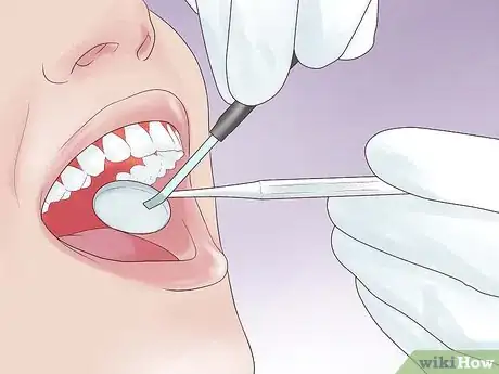 Imagen titulada Protect a Chipped Tooth Step 7