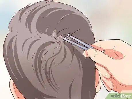 Imagen titulada Measure Hair Loss Step 9