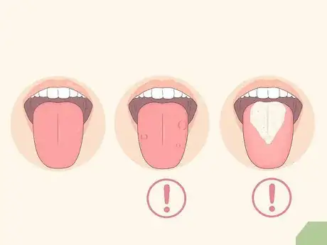 Imagen titulada Clean Your Tongue Properly Step 1