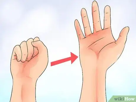 Imagen titulada Exercise After Carpal Tunnel Surgery Step 3