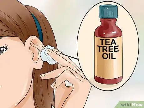 Imagen titulada Get Rid of Pimples Inside the Ear Step 12