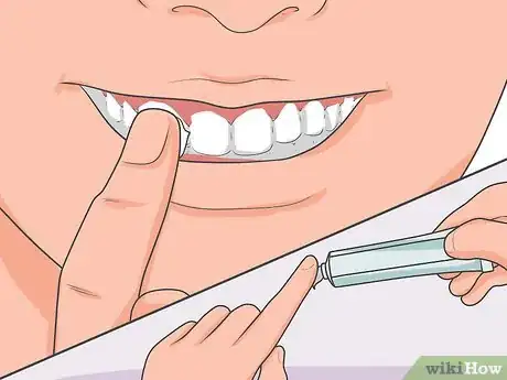 Imagen titulada Cure a Toothache Step 3