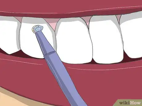 Imagen titulada Apply Tooth Gems Step 13