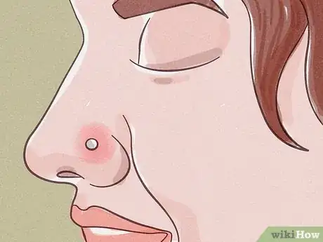 Imagen titulada Treat an Infected Nose Piercing Step 1