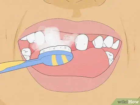 Imagen titulada Pull a Loose Tooth at Home Step 12