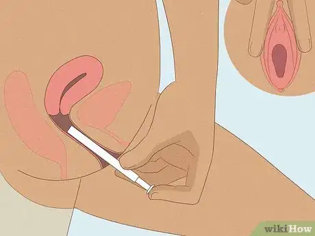 Imagen titulada Apply Vaginal Cream Step 4