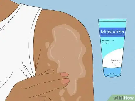 Imagen titulada Cope with Itchy Skin During Menopause Step 2