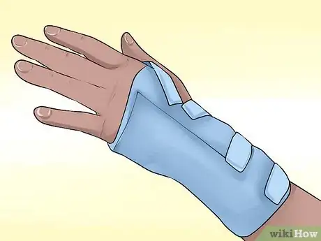 Imagen titulada Wrap a Wrist for Carpal Tunnel Step 15