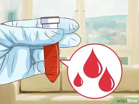 Imagen titulada Measure Blood Oxygen Step 7