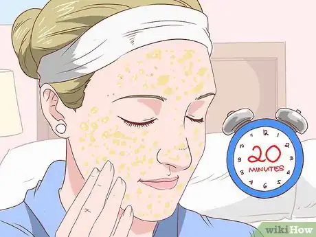 Imagen titulada Get Rid of Acne Without Using Medication Step 23
