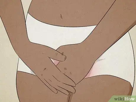 Imagen titulada Get Rid of a Bartholin Cyst Step 9