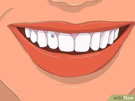 Imagen titulada Apply Tooth Gems Step 14